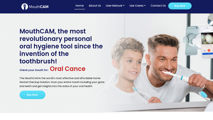 MouthCAM - Intraoral Camera image